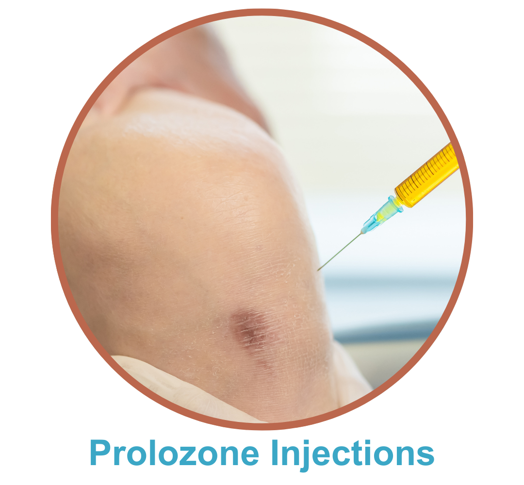 Prolozone Therapy The Karlfeldt Center